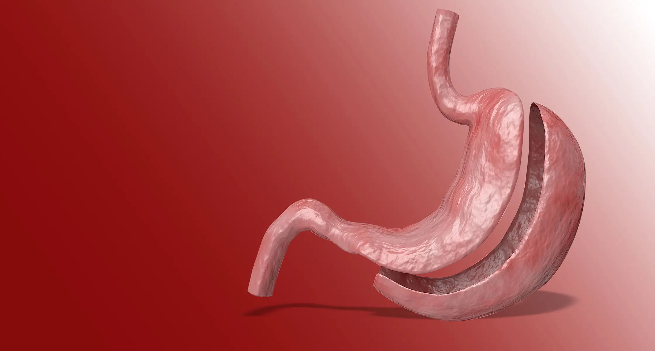 Warum die Magenverkleinerung Türkei Beste klinik weltweit geschätzt wird