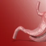 Warum die Magenverkleinerung Türkei Beste klinik weltweit geschätzt wird